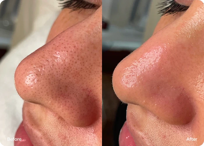 One Facial. So Many Results.