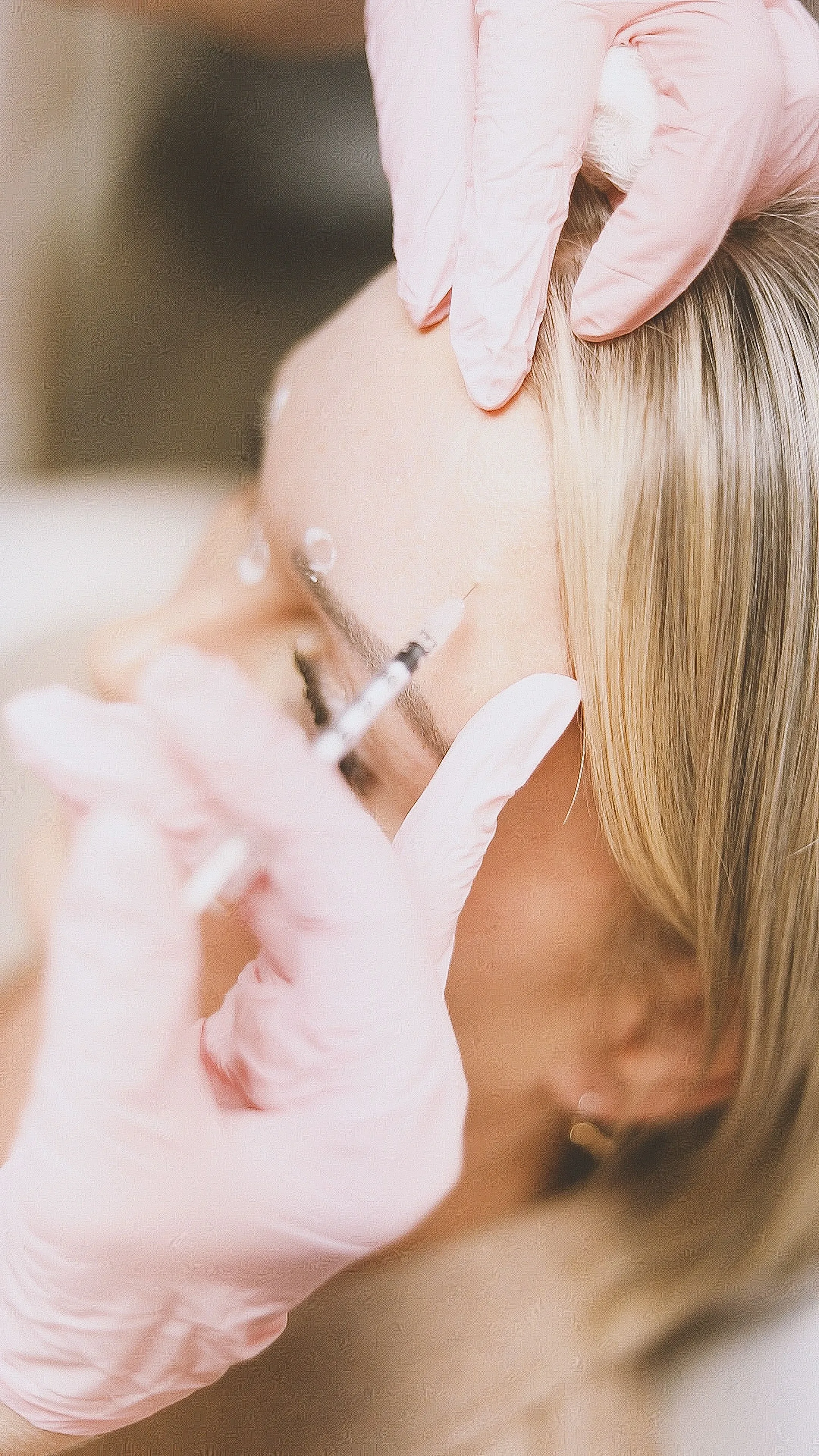 Anti-wrinkle (Botox) injection treatment being administered at Novauria Aesthetics