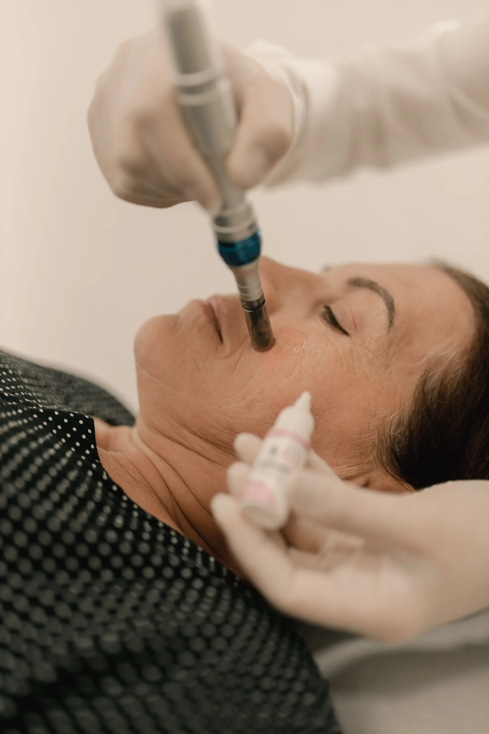 Why Microneedling Deserves a Place in Your Skincare Routine