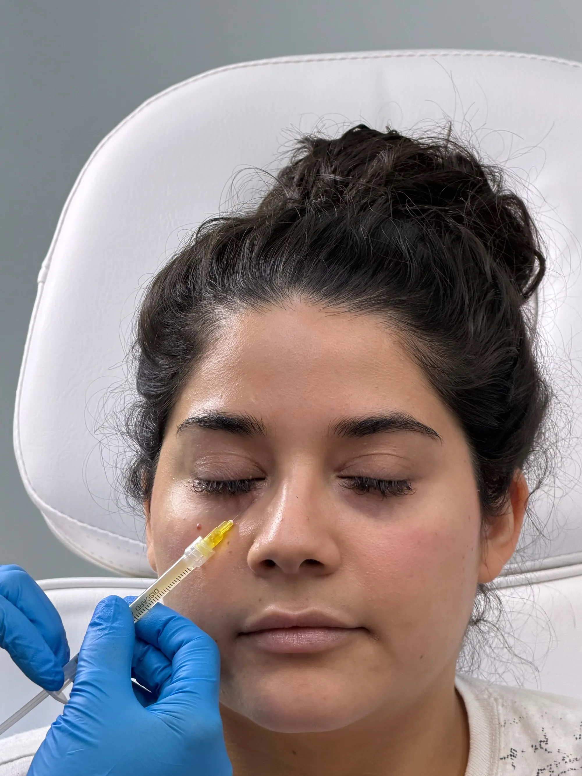 At Novauria Aesthetics, skin boosters can help improve hydration, radiance, texture and overall skin quality for a fresh, healthy-looking glow.