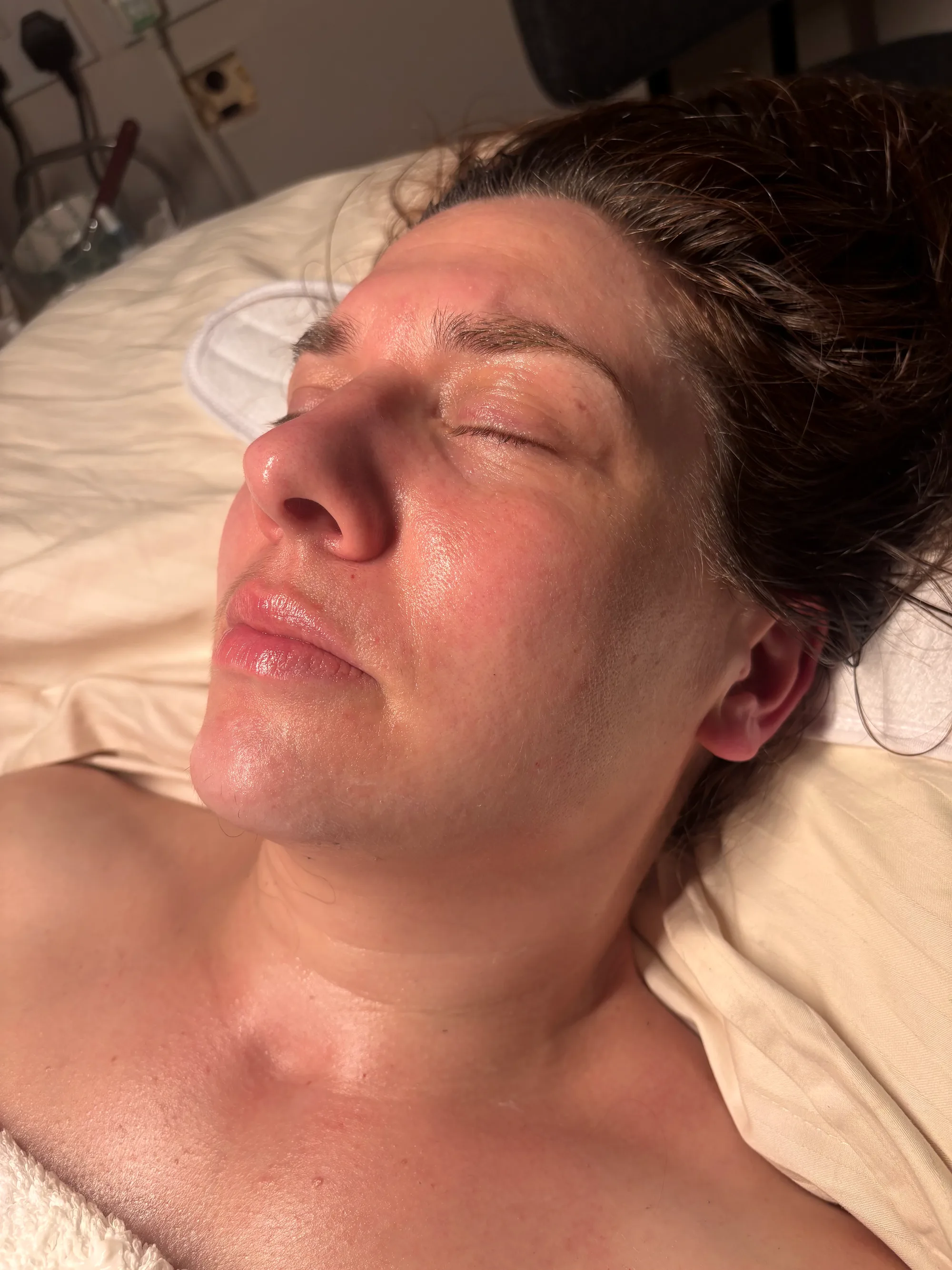 Client with protective eye pads during a facial treatment at Novauria Aesthetics