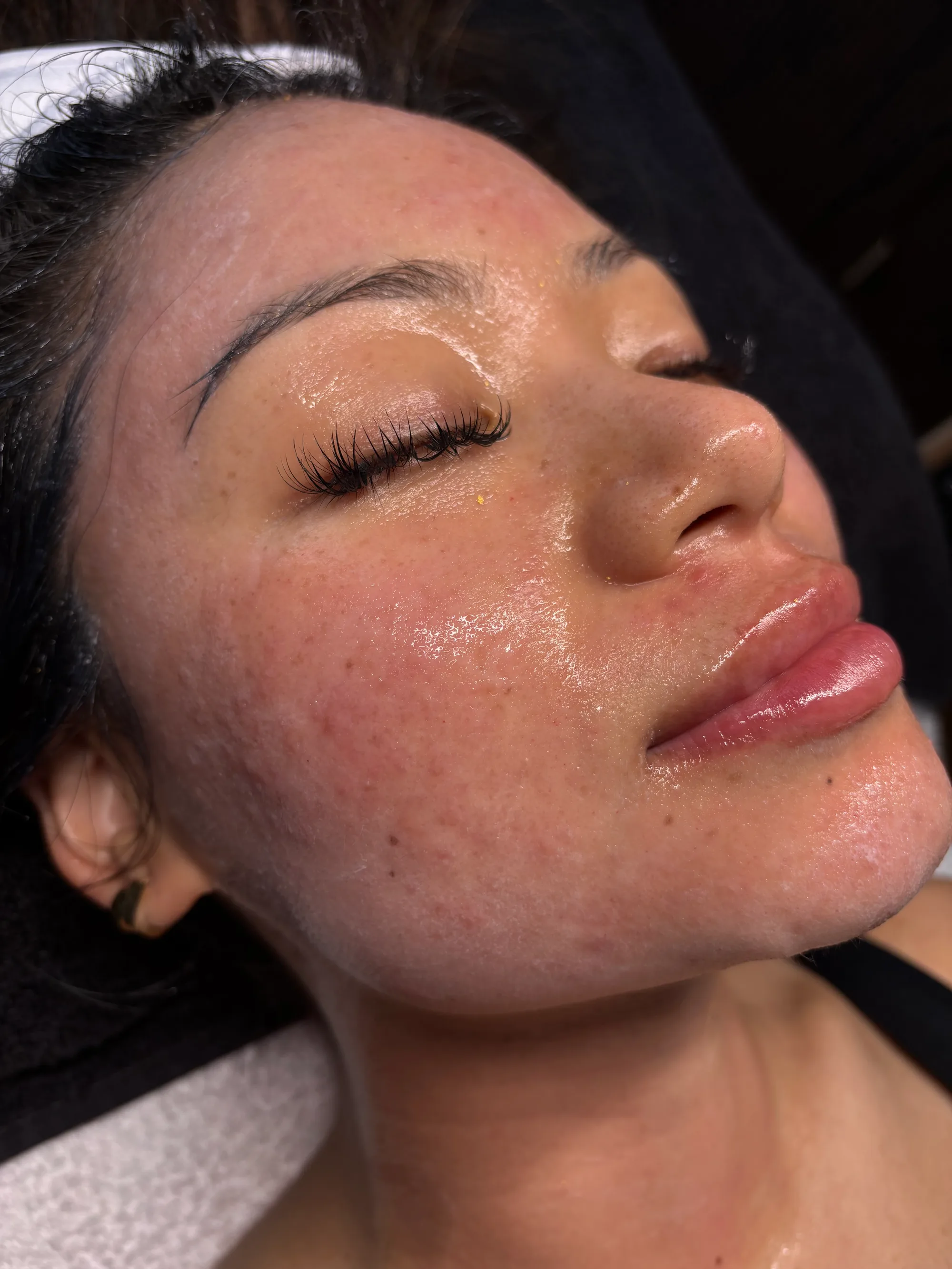 Bespoke Skin Packages